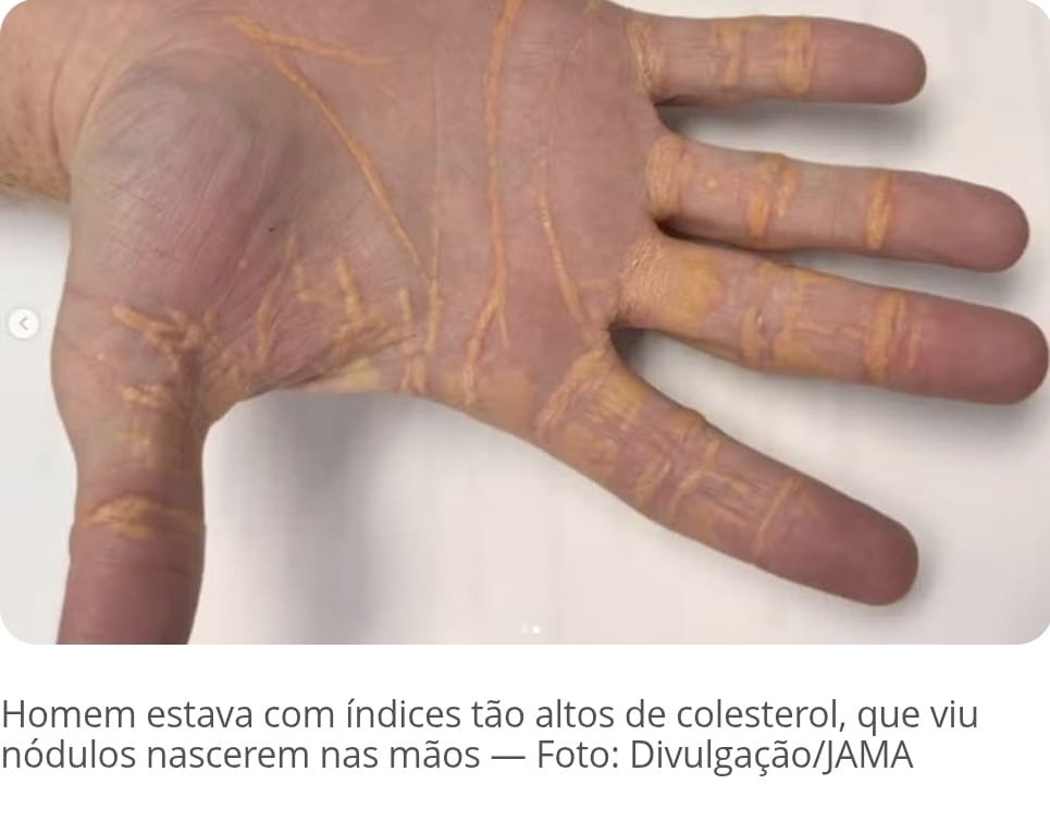 Crônica do Professor Antônio Glauber sobre as notícias do dia 02 de Fevereiro de 2025